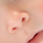 Чем лечить и чем мазать диатез у ребенка на щеках