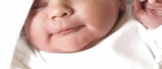 Фото и лечение диатеза у новорожденных на лице