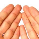 Лечение, причины и фото атопического дерматита на руках